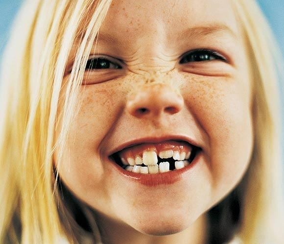 que significa soñar que se te caen los dientes